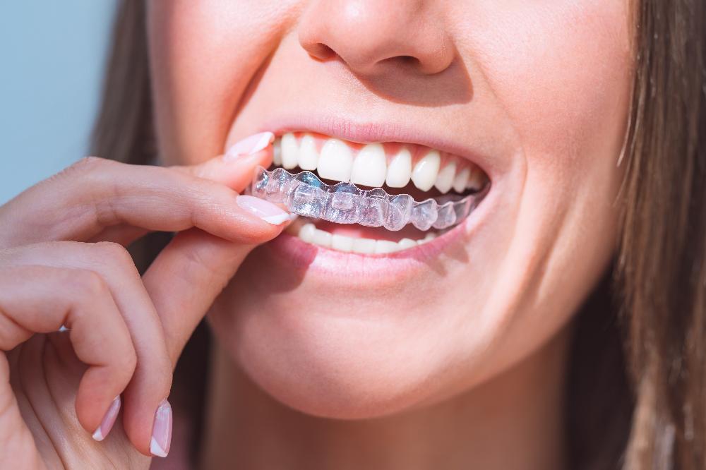 patient putting in invisalign | invisalign bloomington indiana