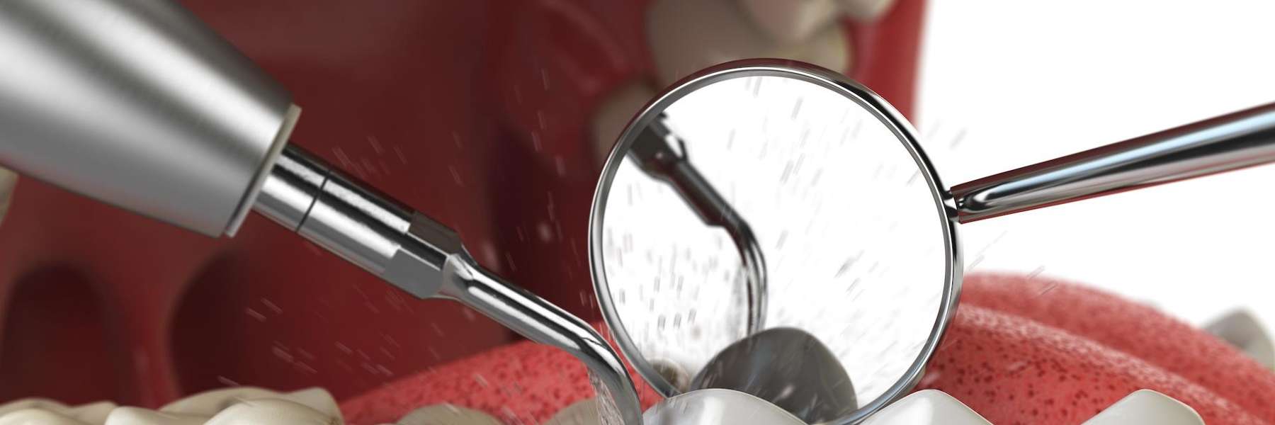 close u of dental tools | sleep apnea dentist bloomington in